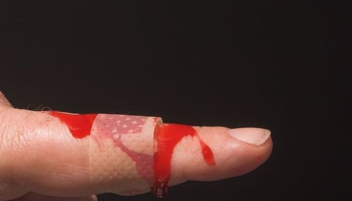 Đứt tay chảy máu đánh con gì? Điềm báo trong tương lai?
